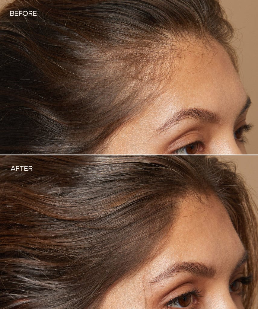 GRO Hair Serum Before and After