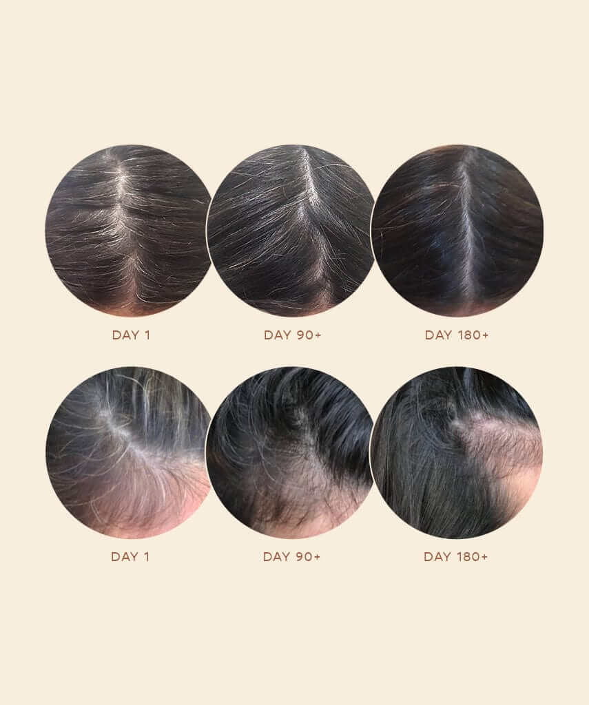 GRO AGELESS Anti-Gray Hair Serum Results